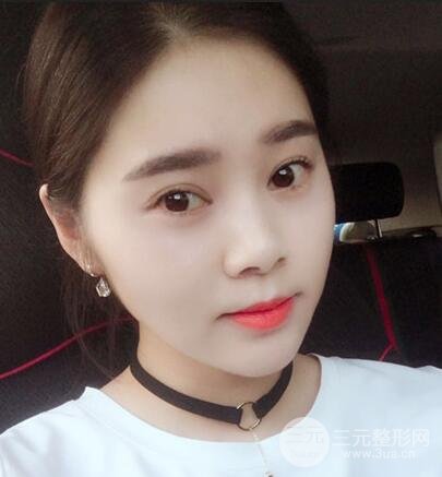 晉城鳳凰整形美容醫(yī)院微針?biāo)夤窒? /> </a>
									</div>
								</dd>
							</dl>
						</div>
					</div>
				</div>

				<div   id=