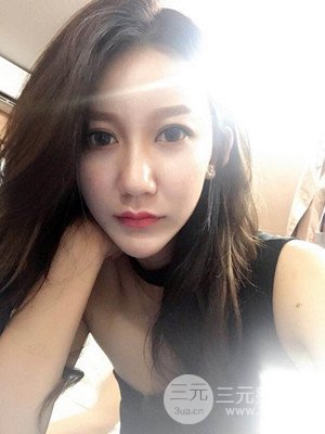 上海原辰自體脂肪填充案例，附上恢復(fù)過程以及對(duì)比圖片