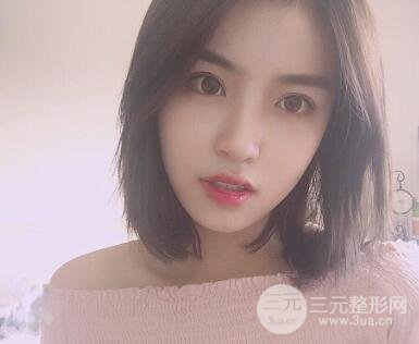 南京康美陳小劍做的雙眼皮案例果真實(shí)的分享給你們！