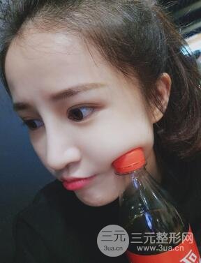 柏麗李勁良假體隆鼻案例果分享！小巧精致又立體~