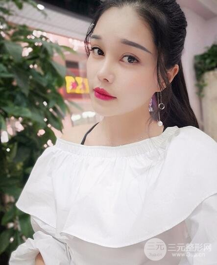 鼻頭縮小術(shù)過程圖，鼻頭縮小恢復(fù)日記