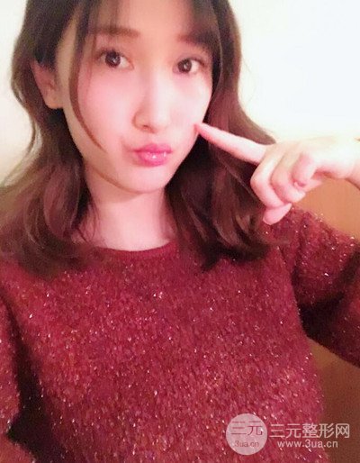 蘇州美貝爾假體隆胸案例，對比圖恢復(fù)過程分享~