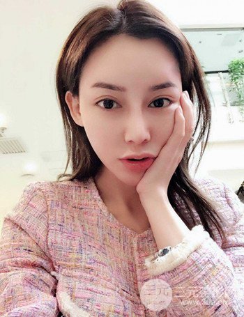 上海隆鼻失敗手術(shù)修復(fù)果超乎想象、前后對(duì)比照片分享