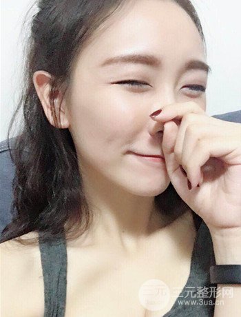 面部埋埋蛋白線.提升改良皮膚松弛，立現(xiàn)小V臉