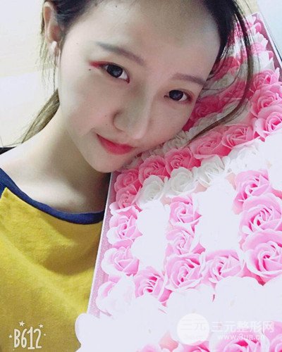 武漢美侖陳遠(yuǎn)海假體隆鼻案例，恢復(fù)過程分享~