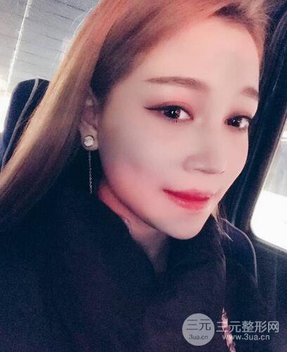 【下頜角+顴骨+下巴】全臉磨骨整形，術(shù)后的我人生開掛了！