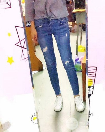 廣州韓妃大腿吸脂案例，恢復(fù)過(guò)程前后對(duì)比圖片分享~