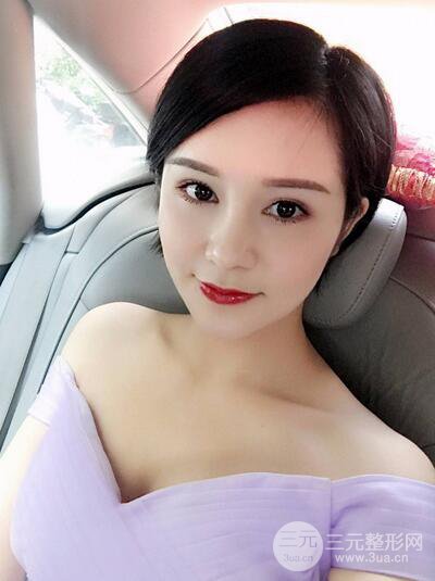 做了隆鼻整形隆鼻之后，短發(fā)女孩也可以性感！