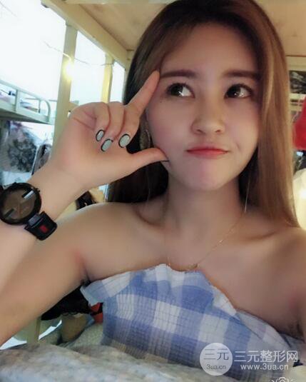 膨體隆鼻術(shù)后恢復(fù)果圖_全過程解密