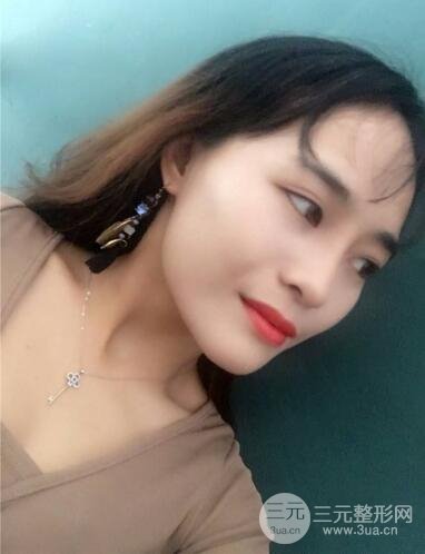 李青峰做隆鼻的風格|案例果圖日記