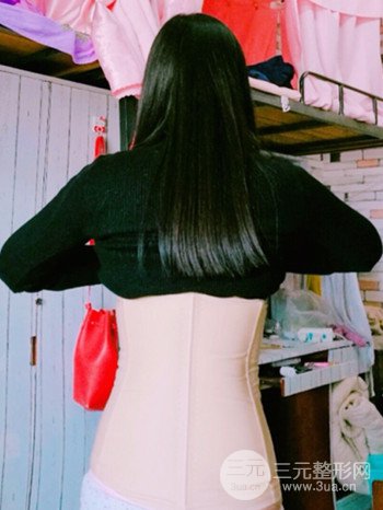 濟(jì)南腰腹吸脂案例三個月前后變化圖片分享