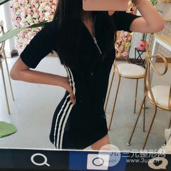 濟(jì)南腰腹吸脂案例三個月前后變化圖片分享