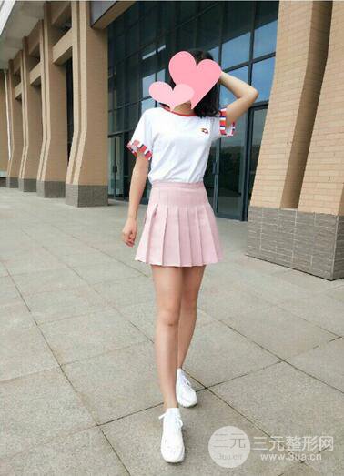 曹衛(wèi)剛大腿吸脂案例恢復圖片記錄分享