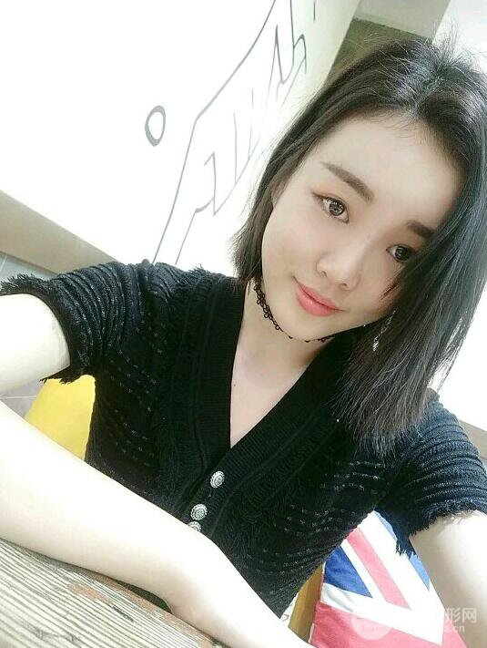 成都軍大鐘正強(qiáng)自體脂肪填充面部案例恢復(fù)圖，馬上變成“初戀臉”