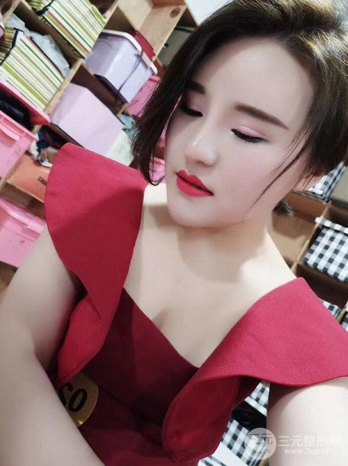 上海麗質(zhì)呂成醫(yī)生做的吸脂瘦臉日記，前后恢復(fù)圖分享