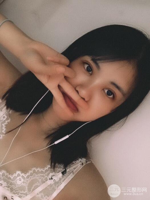 北京禾美嘉任學會自體脂肪面部填充案例分享