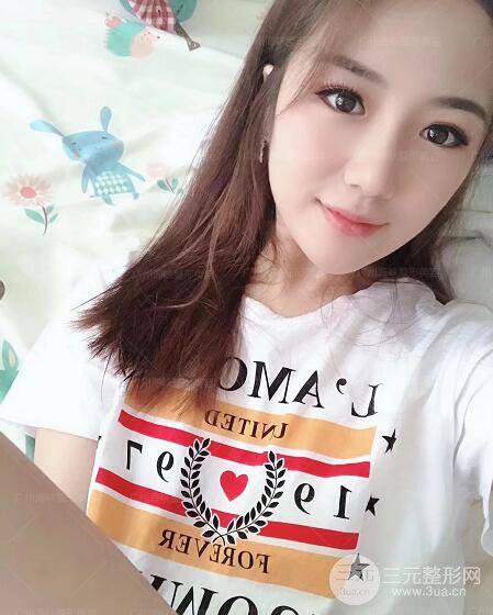 廣州海峽軍隆鼻失敗修復案例術(shù)后記錄