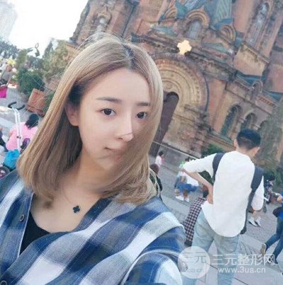 廣州藝美李闖醫(yī)生隆鼻整形恢復記錄分享~