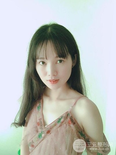 廣州晨曦切開雙眼皮恢復(fù)日記分享，附上前后對(duì)比圖