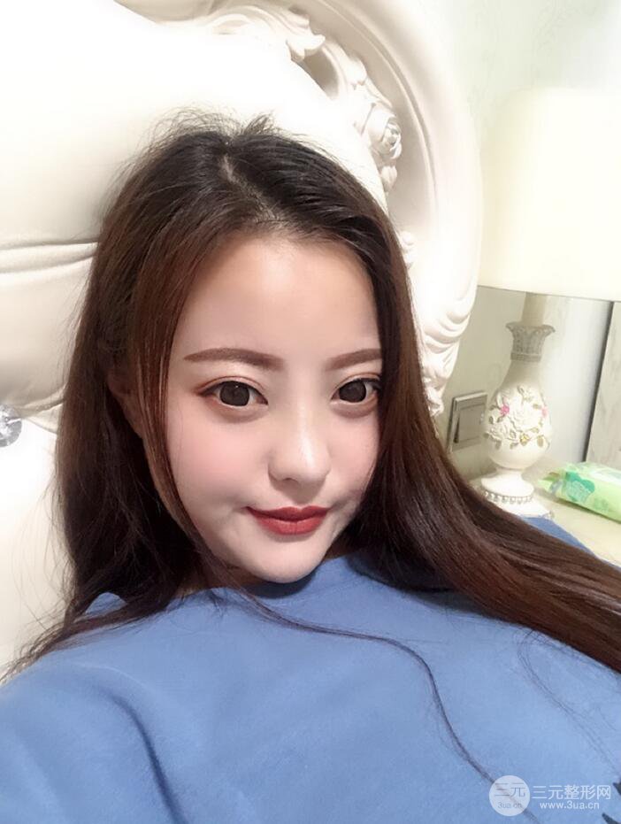 太原麗都面部吸脂+假體隆鼻案例分享，精致面部小V臉了解一下~