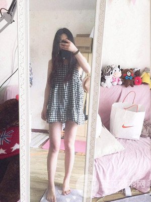 成都艾米麗潘紅偉大腿吸脂案例恢復(fù)過程分享