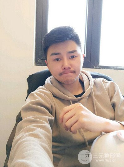 成都玉之光黃開亮醫(yī)生隆鼻修復(fù)整形案例，前后恢復(fù)過程分享