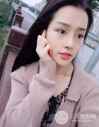 九院李青峰做鼻子的案例風格果圖片分享