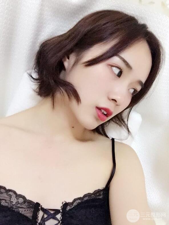 下頜角切除手術(shù)前后恢復(fù)對(duì)比圖過(guò)程分享