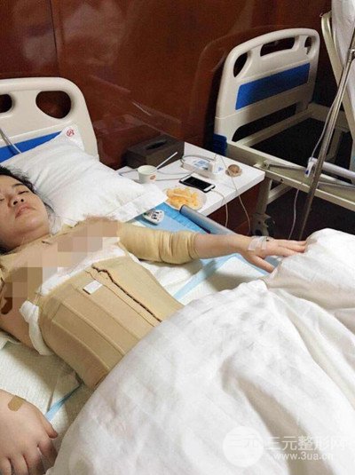 福州美貝爾吸脂案例分享