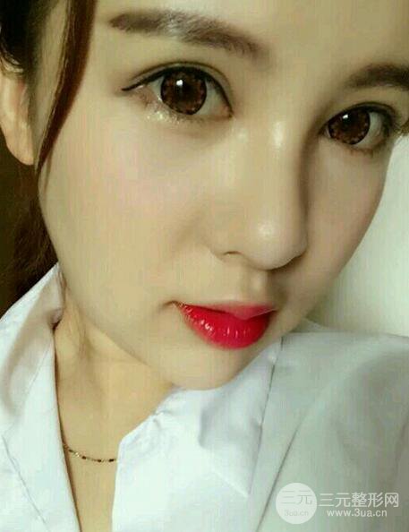 隆鼻整形手術(shù)個(gè)人經(jīng)歷分享，精致小翹鼻不是夢(mèng)