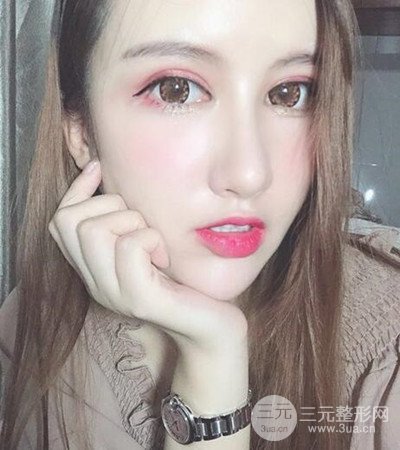 隆鼻整形手術(shù)個(gè)人經(jīng)歷分享，精致小翹鼻不是夢(mèng)