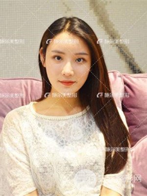 江蘇施爾美自體脂肪填充面部案例，前后對比圖分享