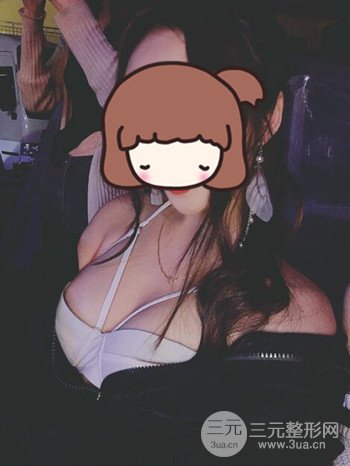 職業(yè)模特做了假體隆胸手術(shù)分享手術(shù)恢復(fù)照片