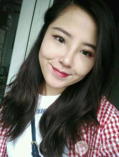 廣州美萊李高峰隆鼻整形案例前后對比圖分享~