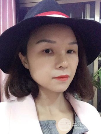 隆鼻整形手術真人案例恢復過程分享 附上果圖