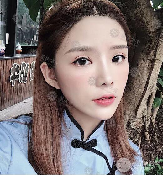 重慶萬州華美潘寶華雙眼皮+內(nèi)眼角前后對比圖被贊氣質(zhì)港風(fēng)女神!