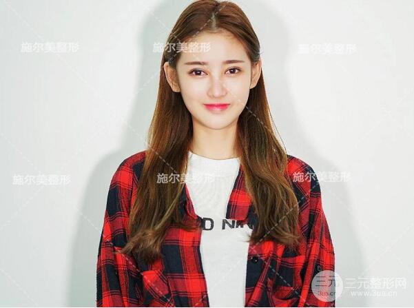 南京施爾美雙眼皮+隆鼻案例術(shù)后恢復(fù)日記