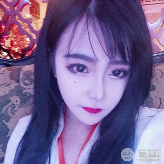 合肥壹加壹甘泉涌軟骨隆鼻前后對比圖|內(nèi)附真人案例恢復(fù)過程