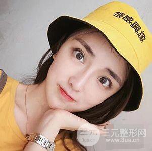 杭州格萊美張樹功假體隆鼻前后對比圖|內(nèi)附恢復(fù)心情變化哦