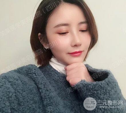 牛永敢醫(yī)生隆鼻案例術(shù)后恢復(fù)記錄詳情