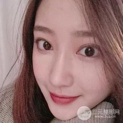 硅膠假體隆鼻案例前后對比圖分享！顏值變化驚人！