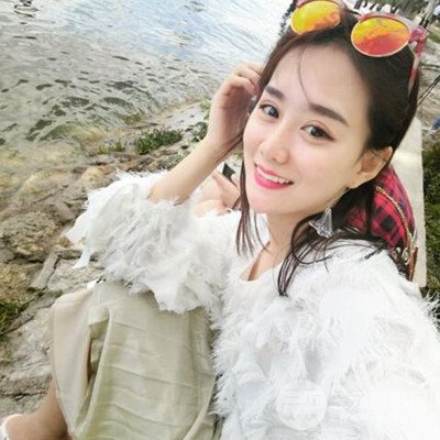 廣州韓妃李光琴隆鼻失敗修復(fù)前后對(duì)比圖分享！