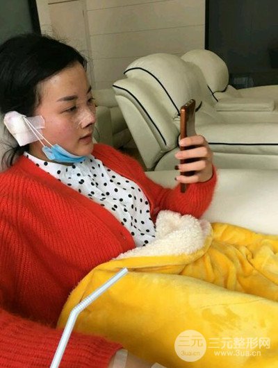 成都艾美薇魏東隆鼻整形手術(shù)前后恢復(fù)果圖分享