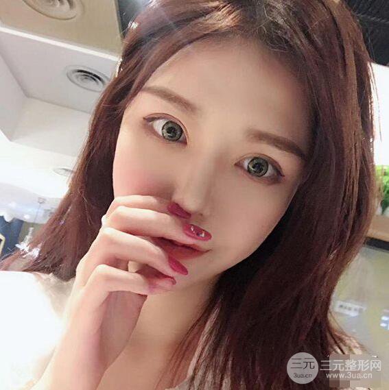 延吉金光善眼部整形失敗修復(fù)前后對比圖 三個月恢復(fù)自然