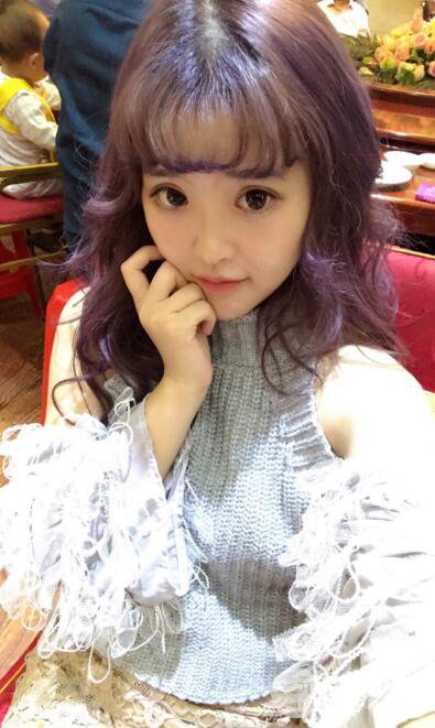 成都天使之翼張勁松切開雙眼皮案例前后對比圖心情小札