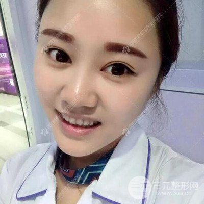 沈陽百嘉麗汪曉蕾自體脂肪面部填充恢復(fù)記錄案例分享~