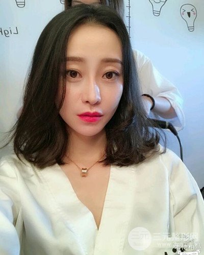 北京雍禾韓巖發(fā)際線種植手術(shù)半年了，分享前后果圖片~