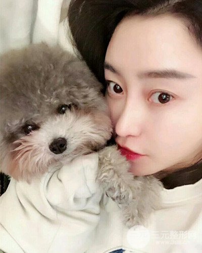 北京雍禾韓巖發(fā)際線種植手術(shù)半年了，分享前后果圖片~