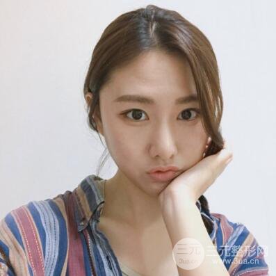 西安葉子魯禮新埋線雙眼皮案例對照圖!兩個月恢復心情小記