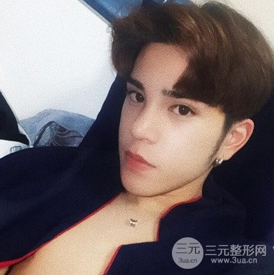 成都蜀尚蓉雅陳建華隆鼻整形前后對比照分享~